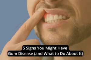 A person pulls back their upper lip to show their teeth and gums, with text overlay: "5 Signs You Might Have Gum Disease (and What to Do About It)".